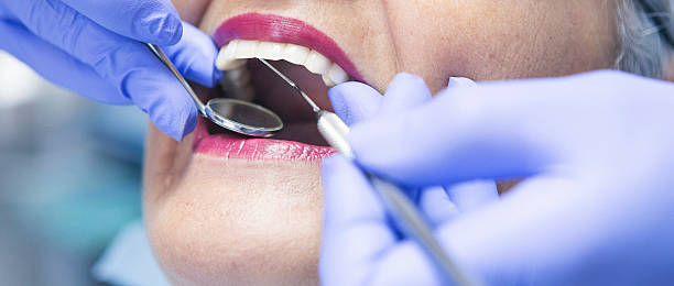 Best Knocked-Out Tooth (Avulsed Tooth) Treatment in Prague, OK