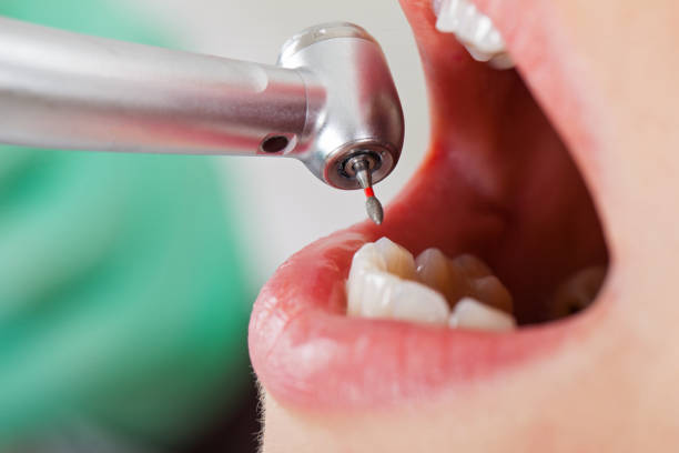 Best Emergency Dental Care for Sports Injuries in Prague, OK